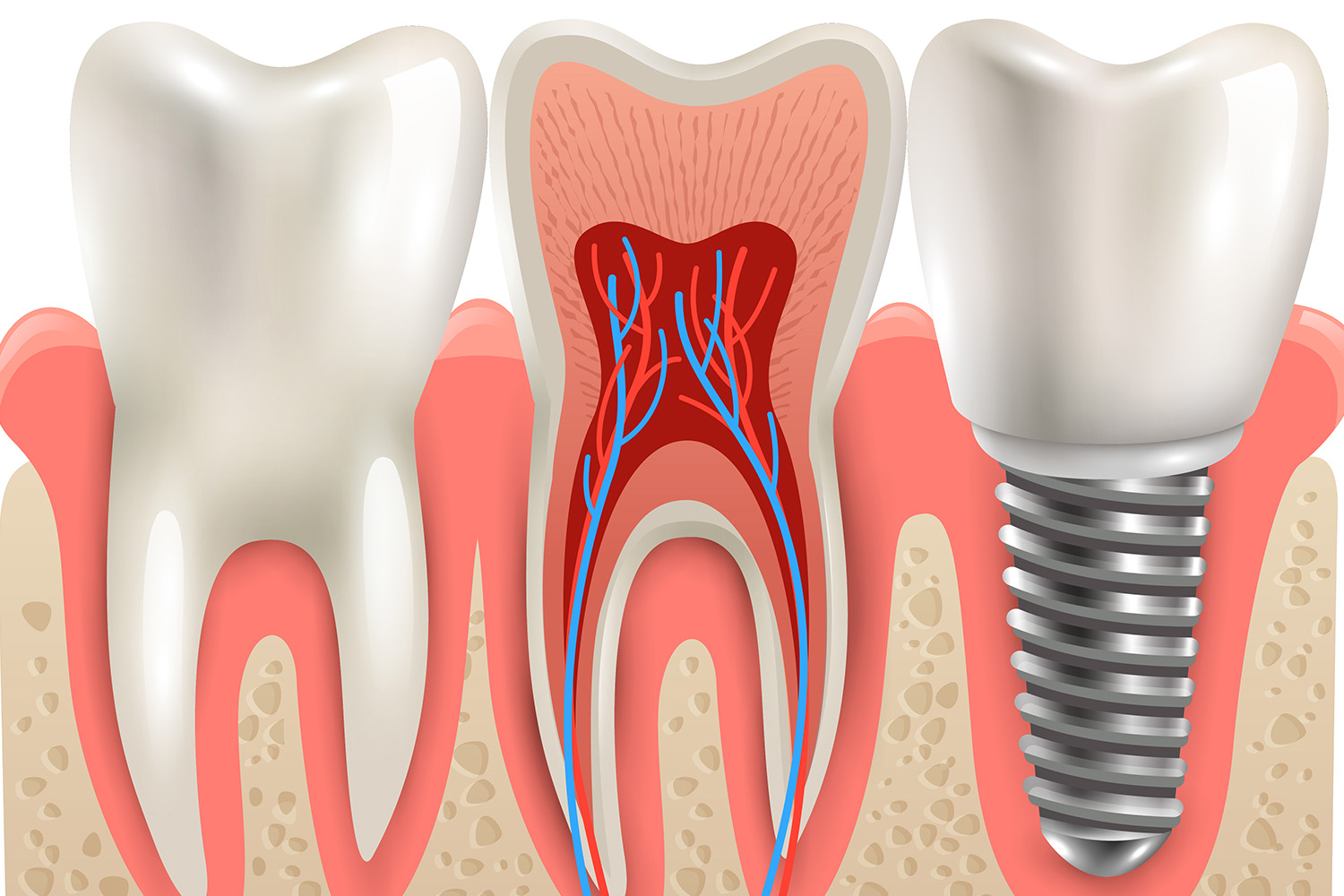 POST OPERATORY INDICATIONS  DENTAL SURGERIES AND IMPLANT